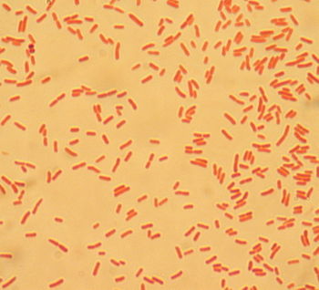 English: Escherichia coli: Gram negative rod o...